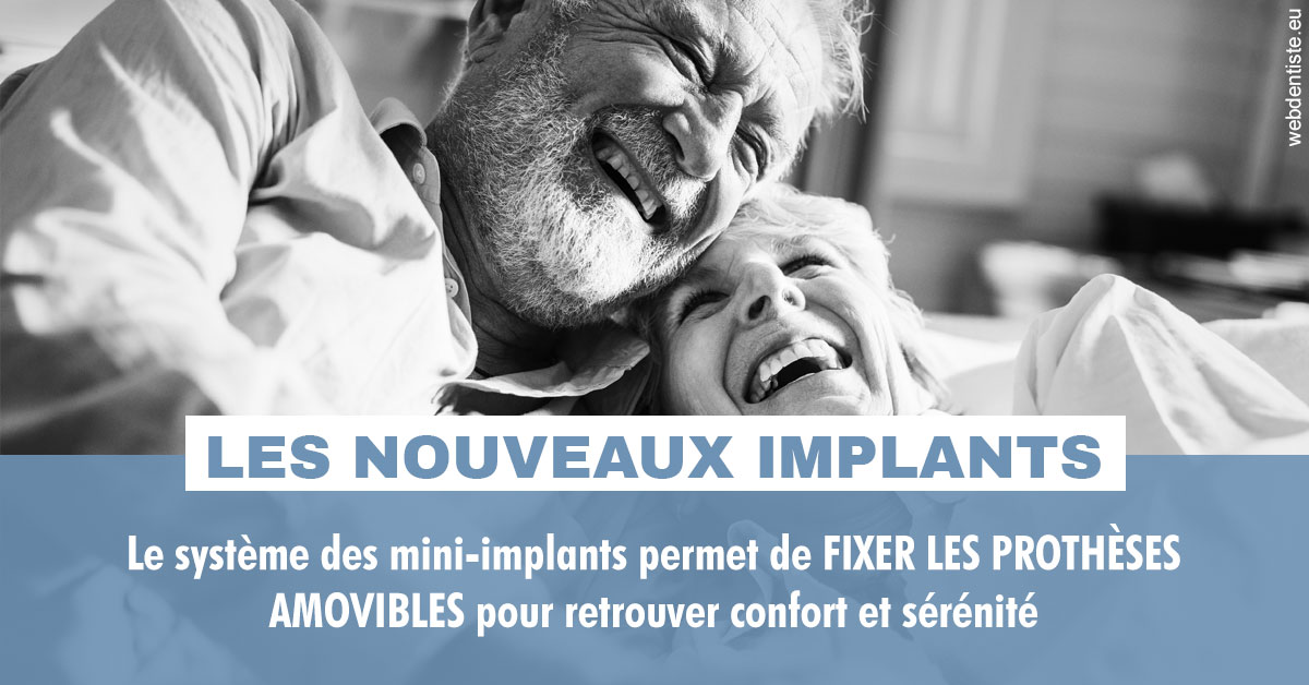 https://selarl-soliwil.chirurgiens-dentistes.fr/Les nouveaux implants 2