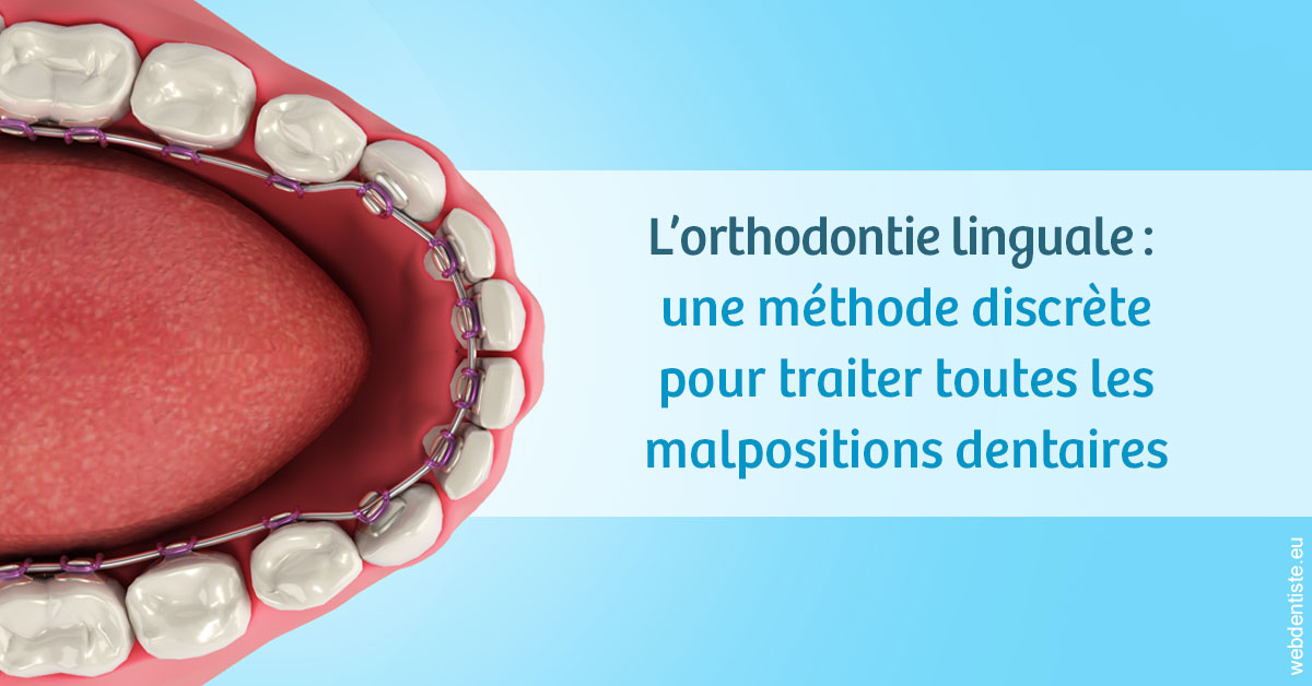 https://selarl-soliwil.chirurgiens-dentistes.fr/L'orthodontie linguale 1