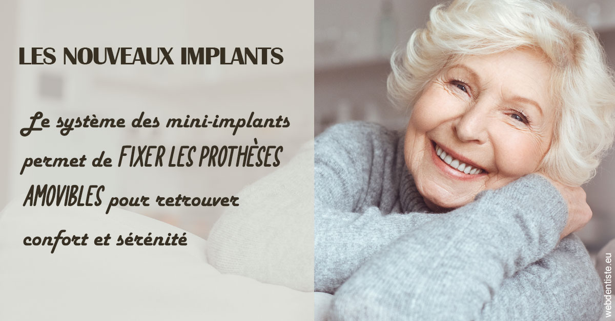 https://selarl-soliwil.chirurgiens-dentistes.fr/Les nouveaux implants 1