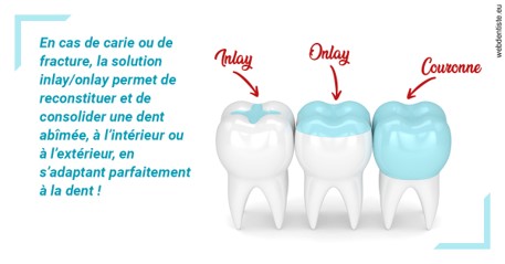 https://selarl-soliwil.chirurgiens-dentistes.fr/L'INLAY ou l'ONLAY