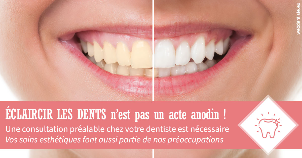 https://selarl-soliwil.chirurgiens-dentistes.fr/Eclaircir les dents 1