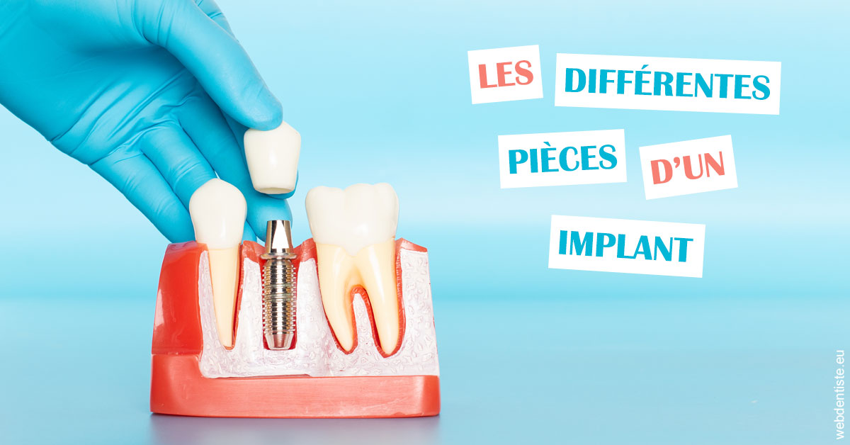 https://selarl-soliwil.chirurgiens-dentistes.fr/Les différentes pièces d’un implant 2