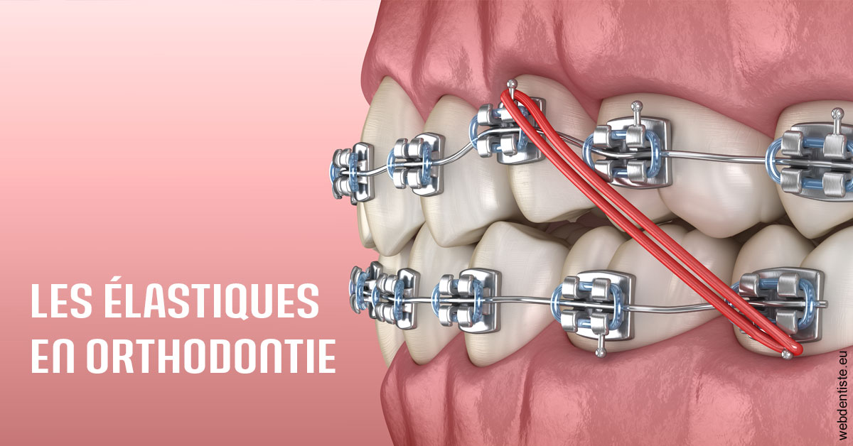 https://selarl-soliwil.chirurgiens-dentistes.fr/Elastiques orthodontie 2
