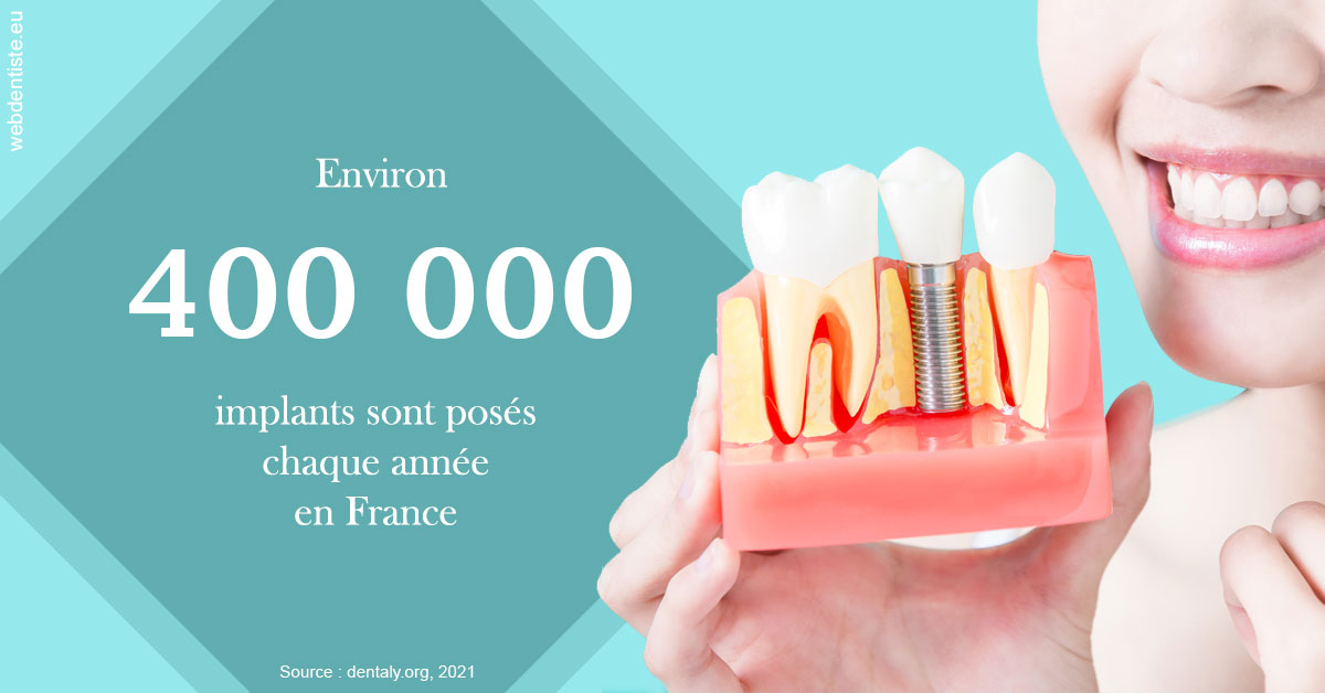 https://selarl-soliwil.chirurgiens-dentistes.fr/Pose d'implants en France 2